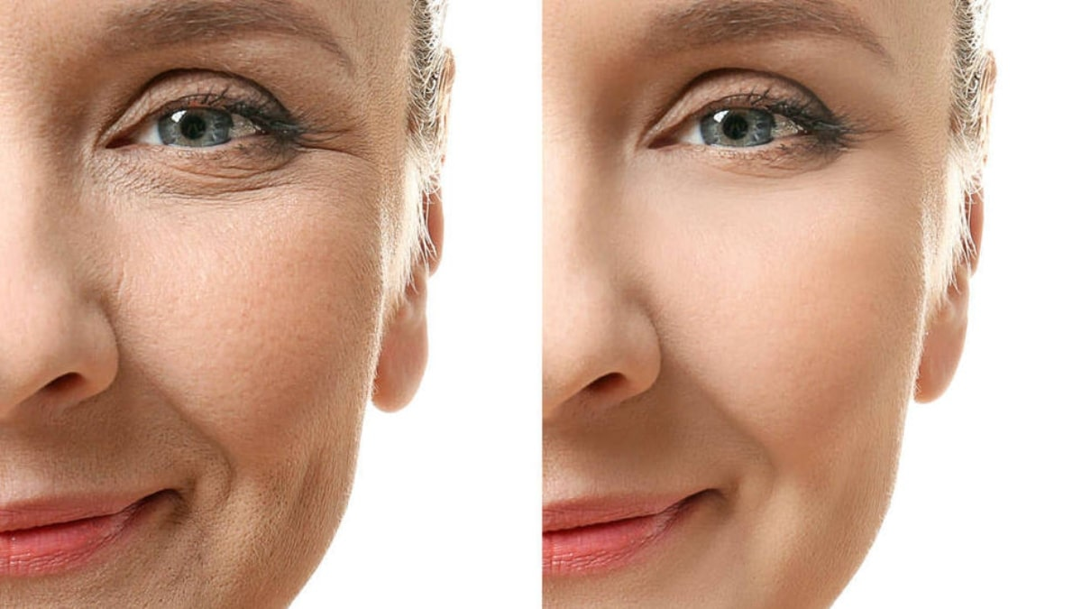 Skin Tightening vs. Anti-ageing: Which Is Right for You...