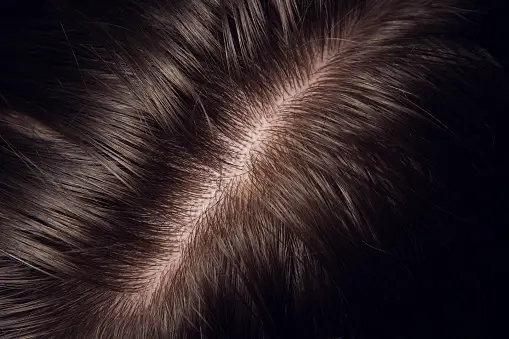 Innovations in Hair Care: The Rise of Restoring Scalp Serums 3 Innovations in Hair Care: The Rise of Restoring Scalp Serums 3