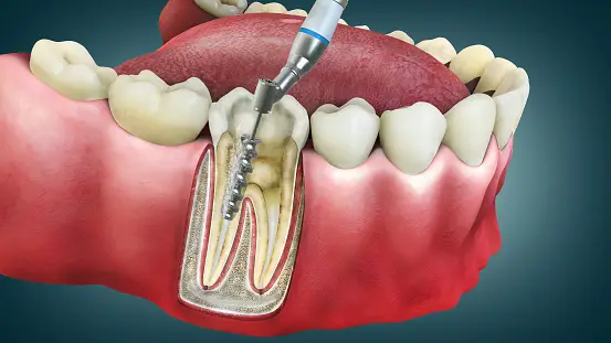 Dental Care